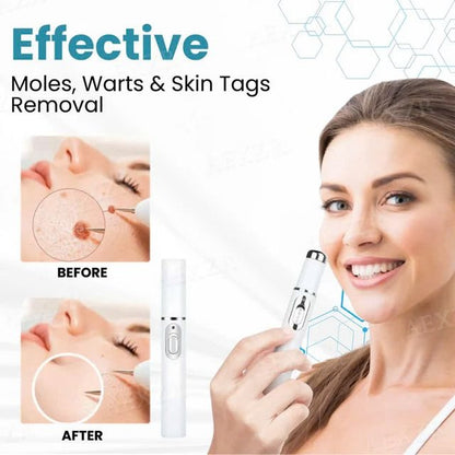 Xorita Wart Remover