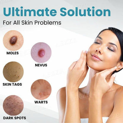 Xorita Wart Remover
